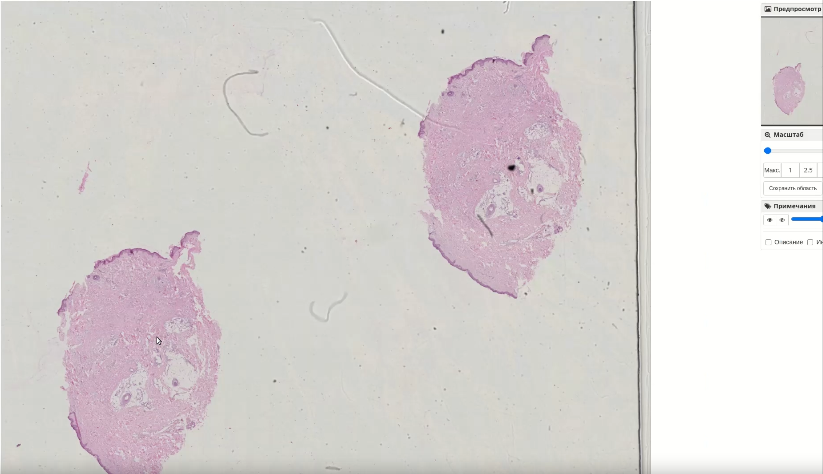 Kometa Pathology PACS — 3